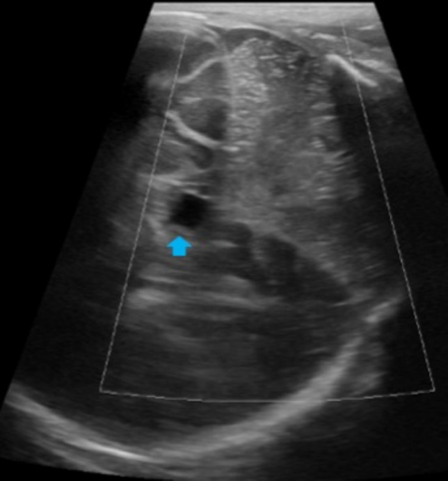 Fig. 2