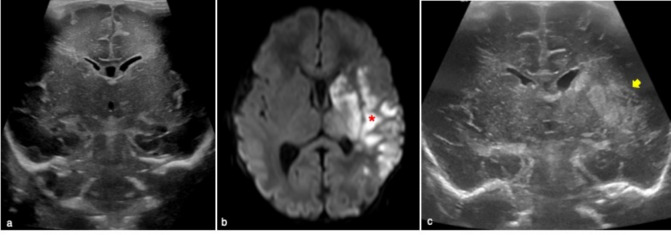 Fig. 11