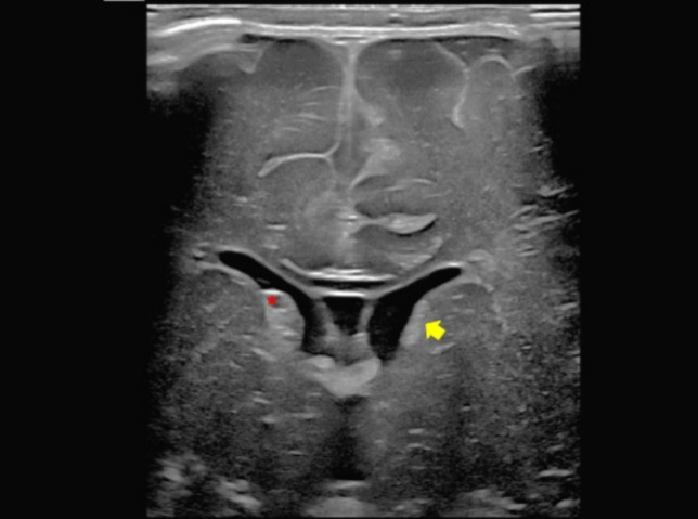 Fig. 6