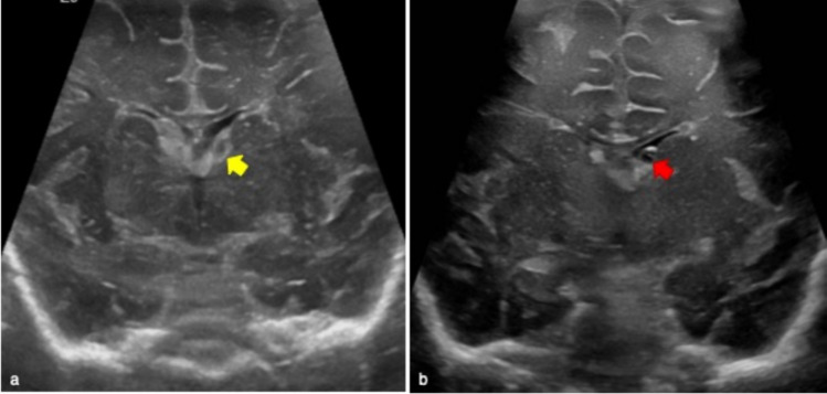 Fig. 8