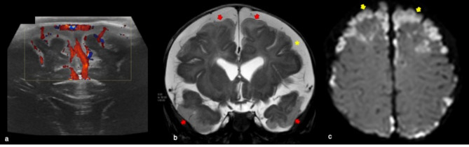 Fig. 14