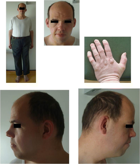 Fig. 1