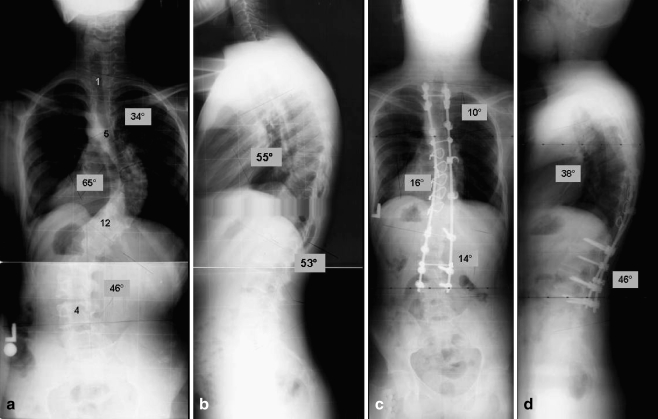 Fig. 1