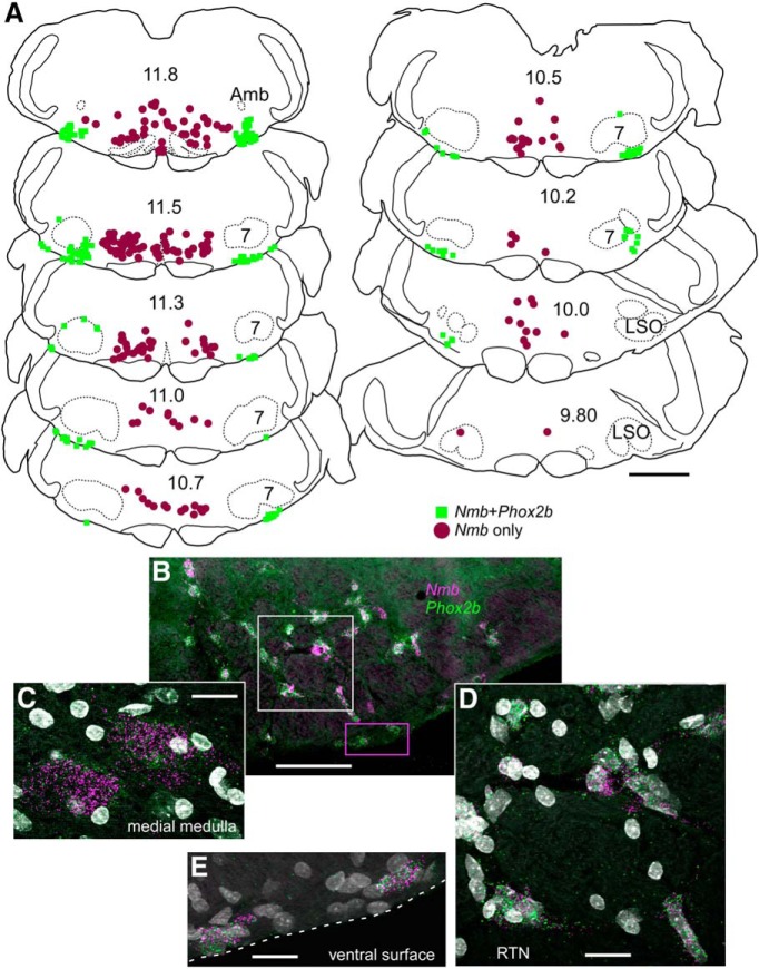 Figure 11.