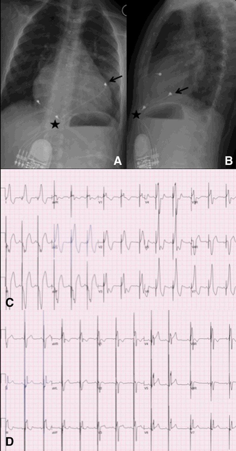 Fig. 5