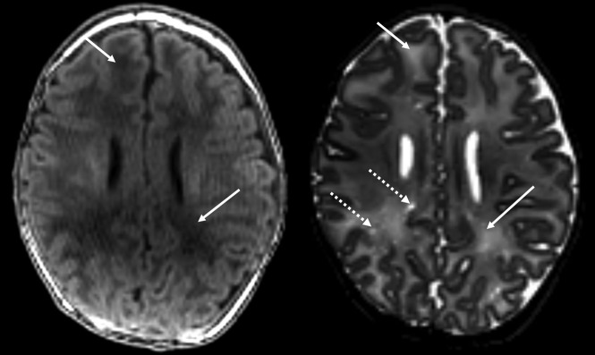 Fig 2.