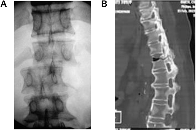 Fig. 2