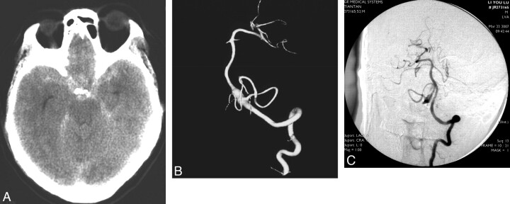 Fig 2.