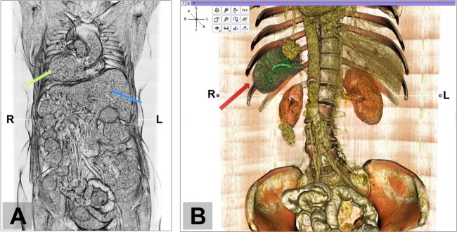 Figure 2