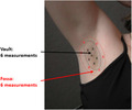 graphic file with name ICS-42-436-g005.jpg