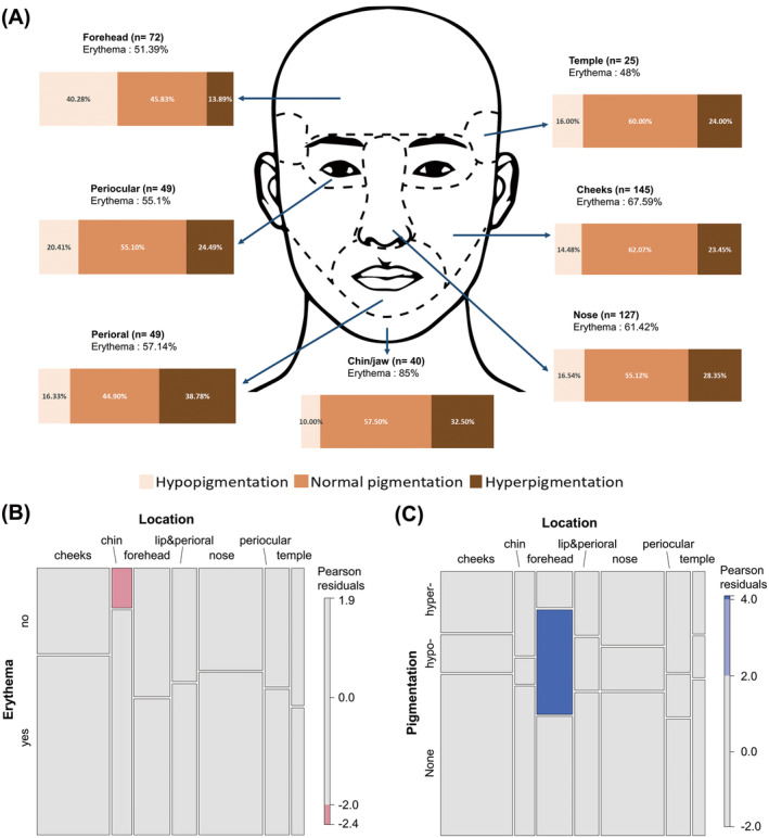 Morphological Characteristics Of Facial Scars A Retrospective Analysis