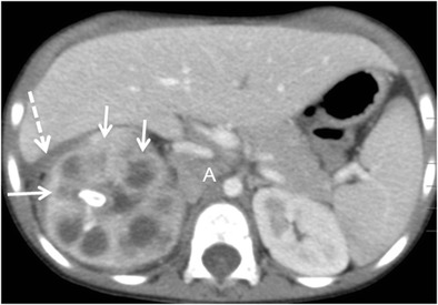 Fig. 11
