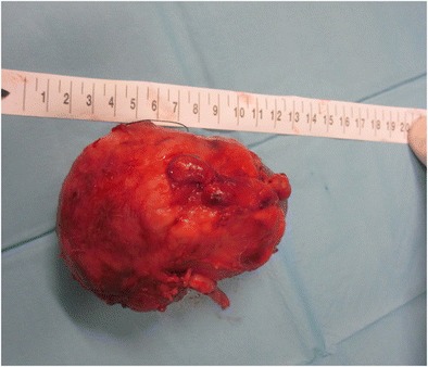 Fig. 18
