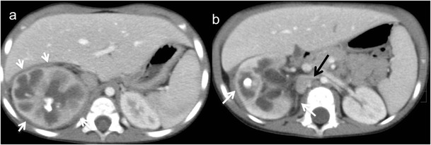Fig. 14