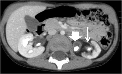 Fig. 13