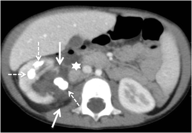 Fig. 12