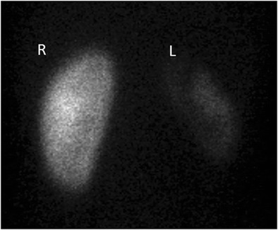 Fig. 16