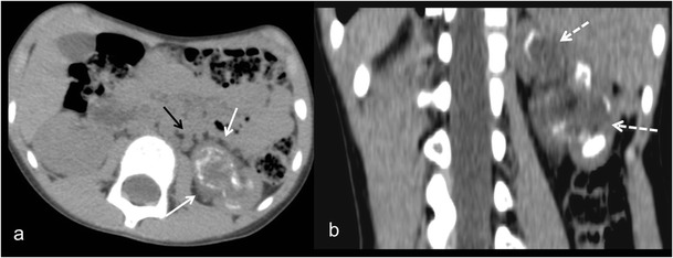 Fig. 15