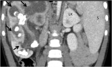 Fig. 10