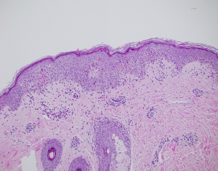 Fig 4