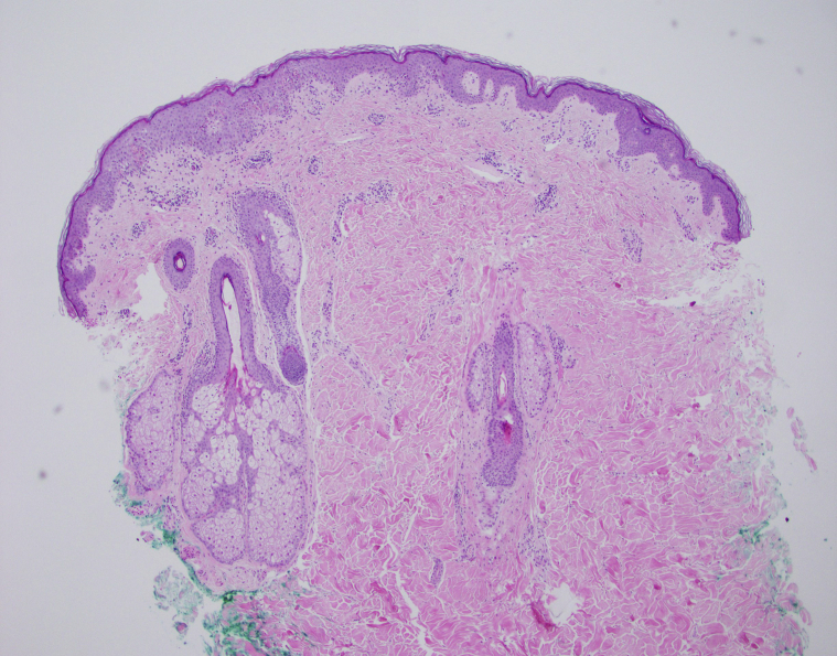 Fig 3