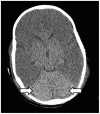 Figure 12.