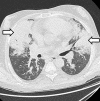 Figure 11.