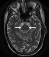Figure 13.