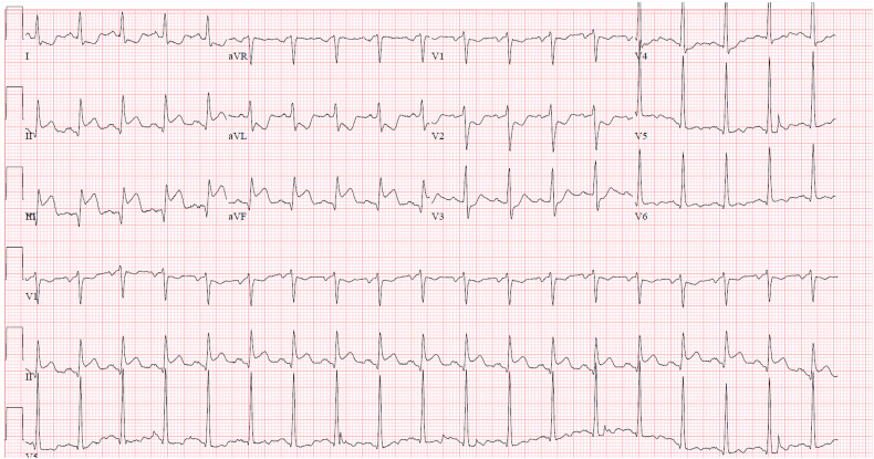 Fig. 3.1