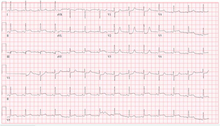 Fig. 1.1