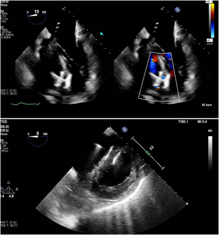 Fig. 4.3