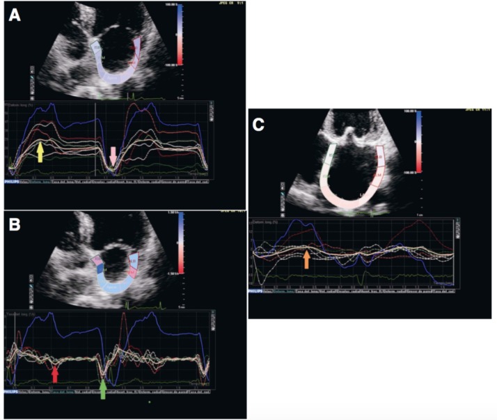 Fig. (4)