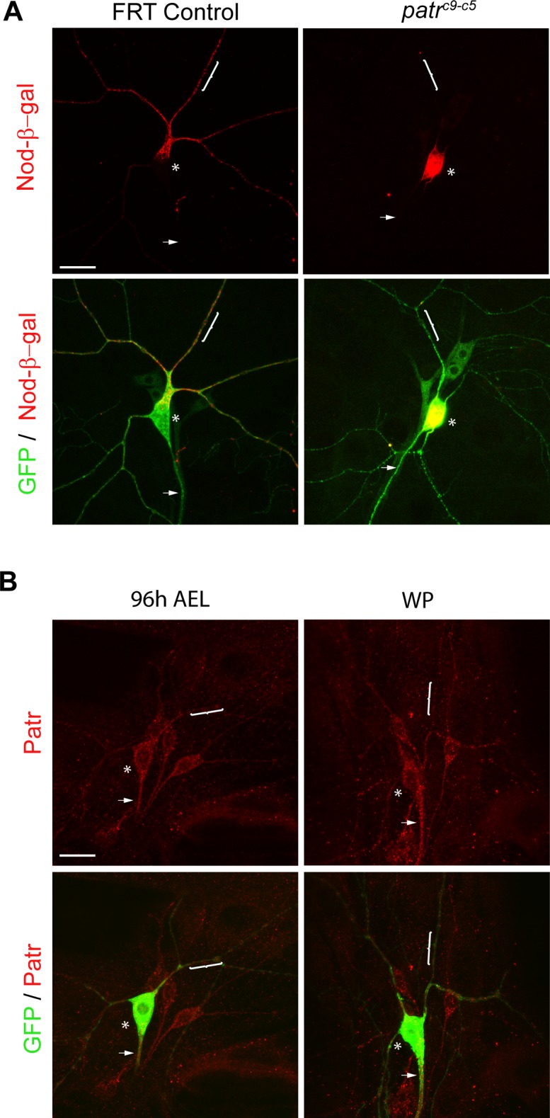 Figure 4—figure supplement 1.