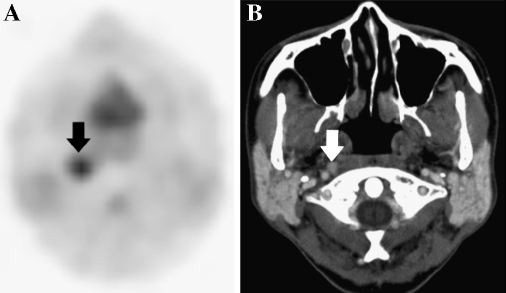 Fig. 4