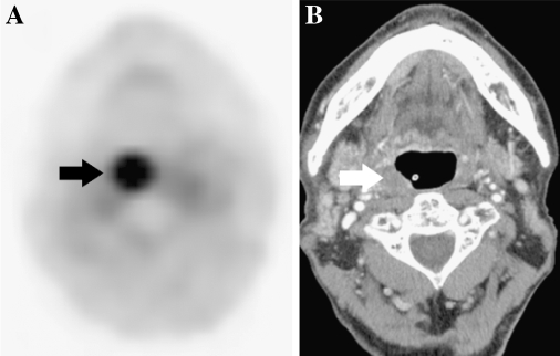 Fig. 3