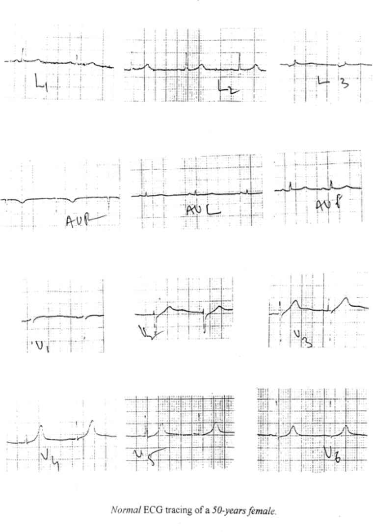 Figure 4a: