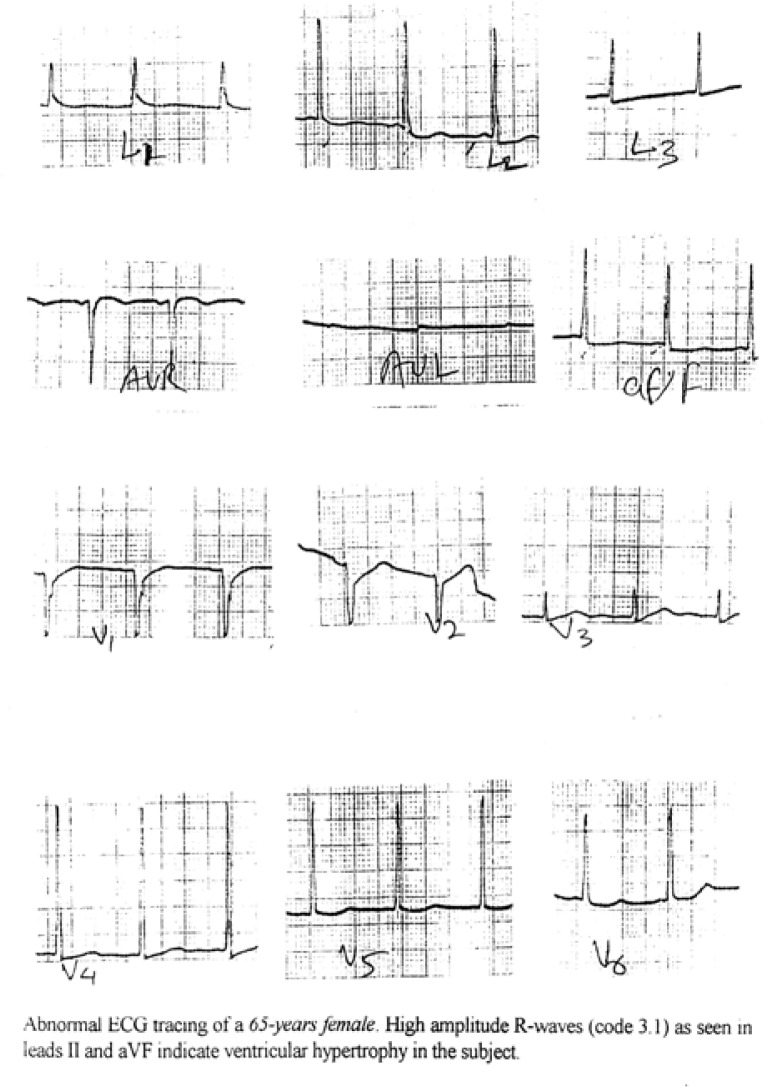 Figure 4c: