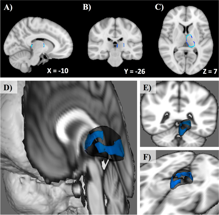 Fig. 3