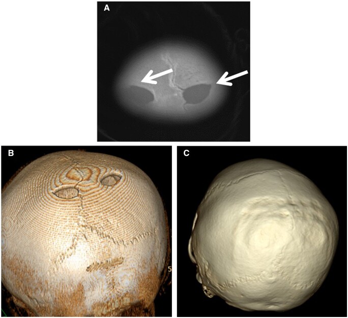 Figure 11.