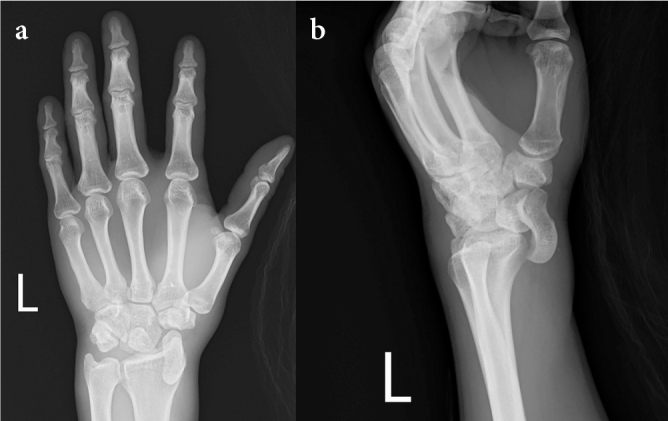 Figure 1. a, b