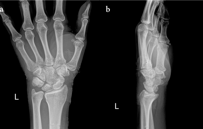 Figure 4. a, b