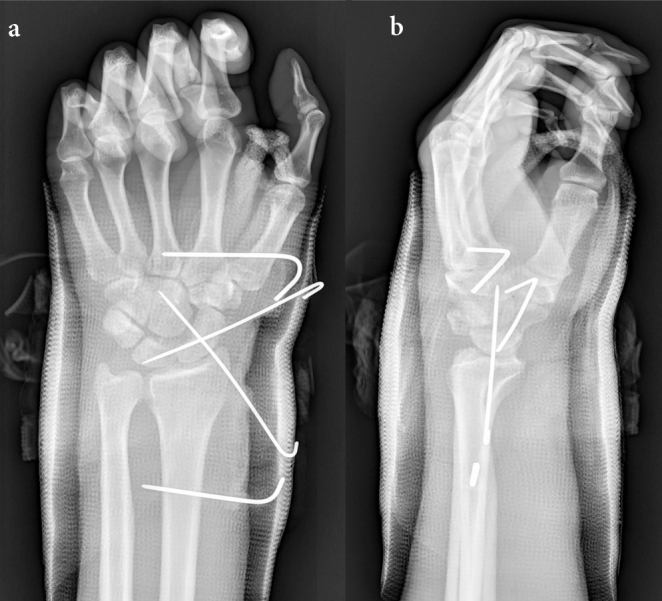 Figure 3. a, b