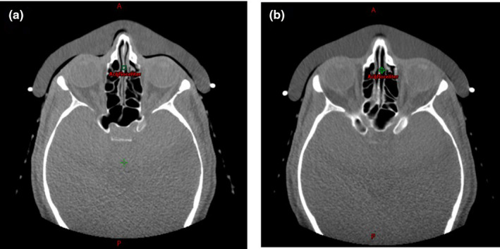 FIG. 6