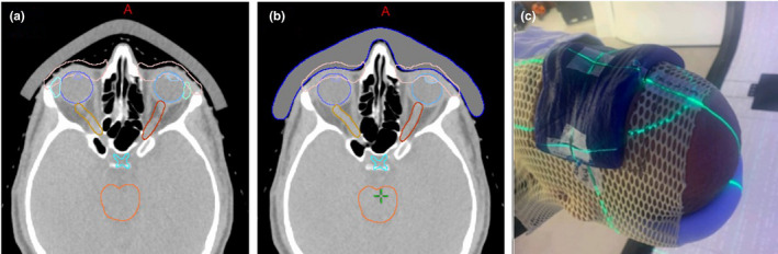 FIG. 1