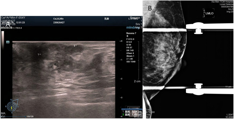 Figure 1