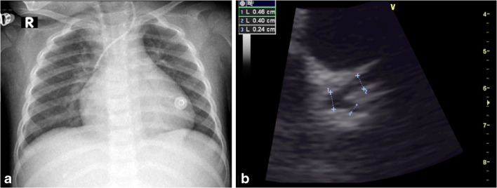 Fig. 4