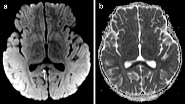 Fig. 9