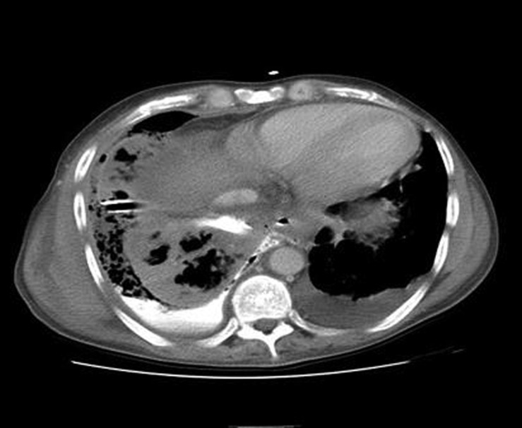 Figure 2