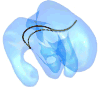 Fig. 12