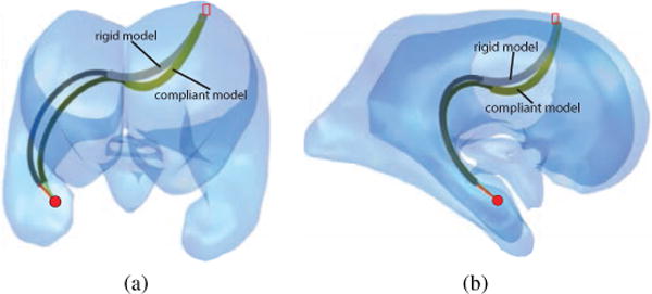 Fig. 11